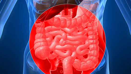 Bağırsak Tümörü Belirtileri ve Tedavisi